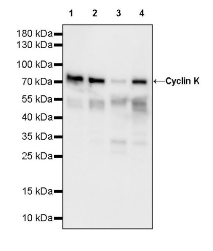 Cyclin K Recombinant Rabbit mAb (S-1586-18)