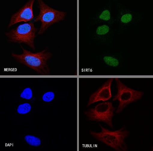 SIRT6 Recombinant Rabbit mAb (S-885-56)