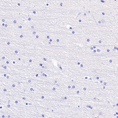 B7-H6 Recombinant Rabbit mAb (SDT-3241-6)