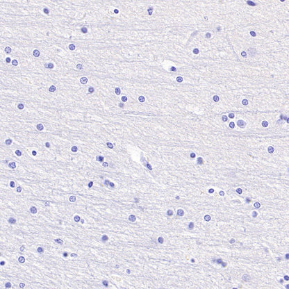 B7-H6 Recombinant Rabbit mAb (SDT-3241-6)