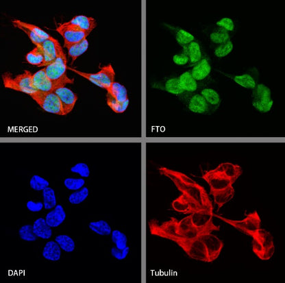 FTO Recombinant Rabbit mAb (S-1663-48)