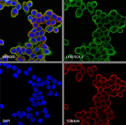 LY6E/SCA-2 Recombinant Rabbit mAb (S-2681-56)