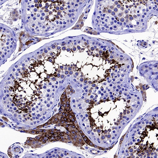 Angiotensin Converting Enzyme 1 Recombinant Rabbit mAb (SDT-2662-122)