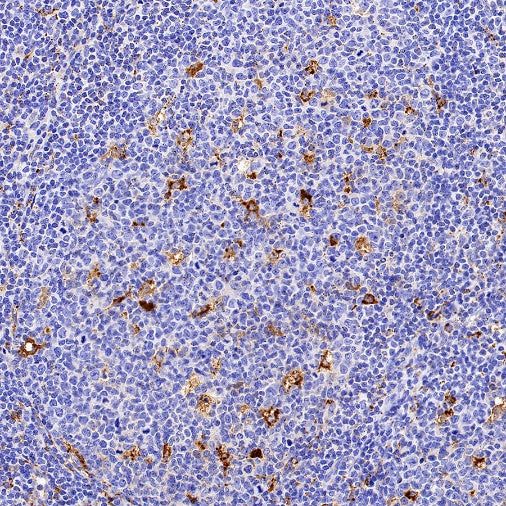 Cathepsin B Recombinant Rabbit mAb (S-1067-7)