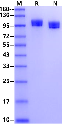 NCAM-1/CD56 His Tag Protein, Rat