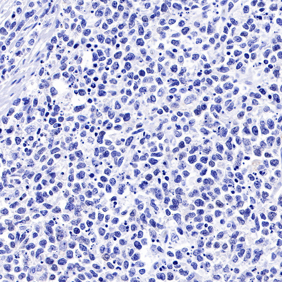 SOX9 Recombinant Rabbit mAb (SDT-019-29)