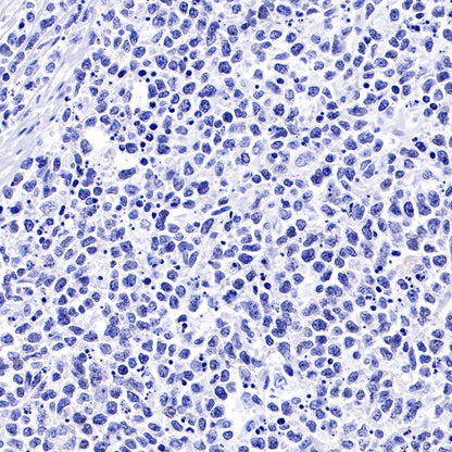 SOX9 Recombinant Rabbit mAb (SDT-019-29)