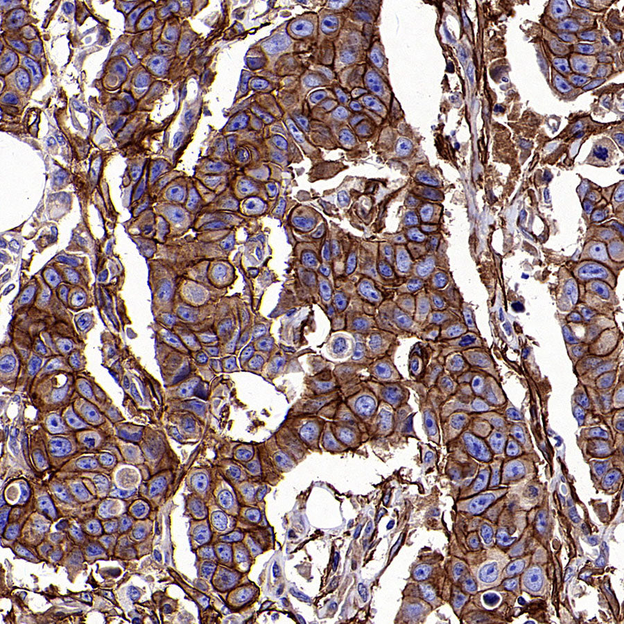 PTK7 Recombinant Rabbit mAb ,PBS Only(SDT-2432-136)