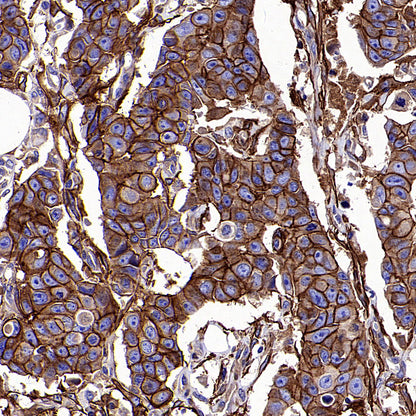 PTK7 Recombinant Rabbit mAb ,PBS Only(SDT-2432-136)