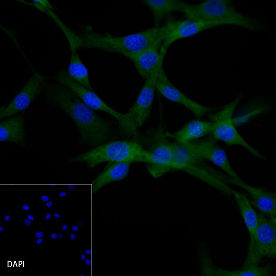 β-tubulin Recombinant Rabbit mAb (FITC Conjugate) (SDT-R014)