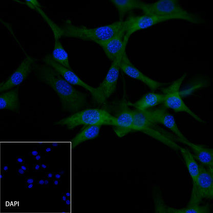 β-tubulin Recombinant Rabbit mAb (FITC Conjugate) (SDT-R014)