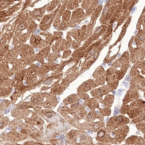 NDRG2 Recombinant Rabbit mAb (S-618-76)