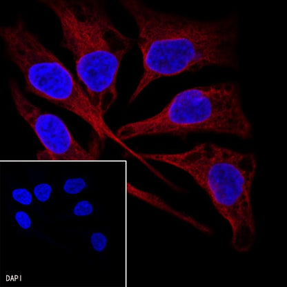 Goat anti-Rabbit IgG(H+L) (Alexa Fluor® 594 Conjugate)
