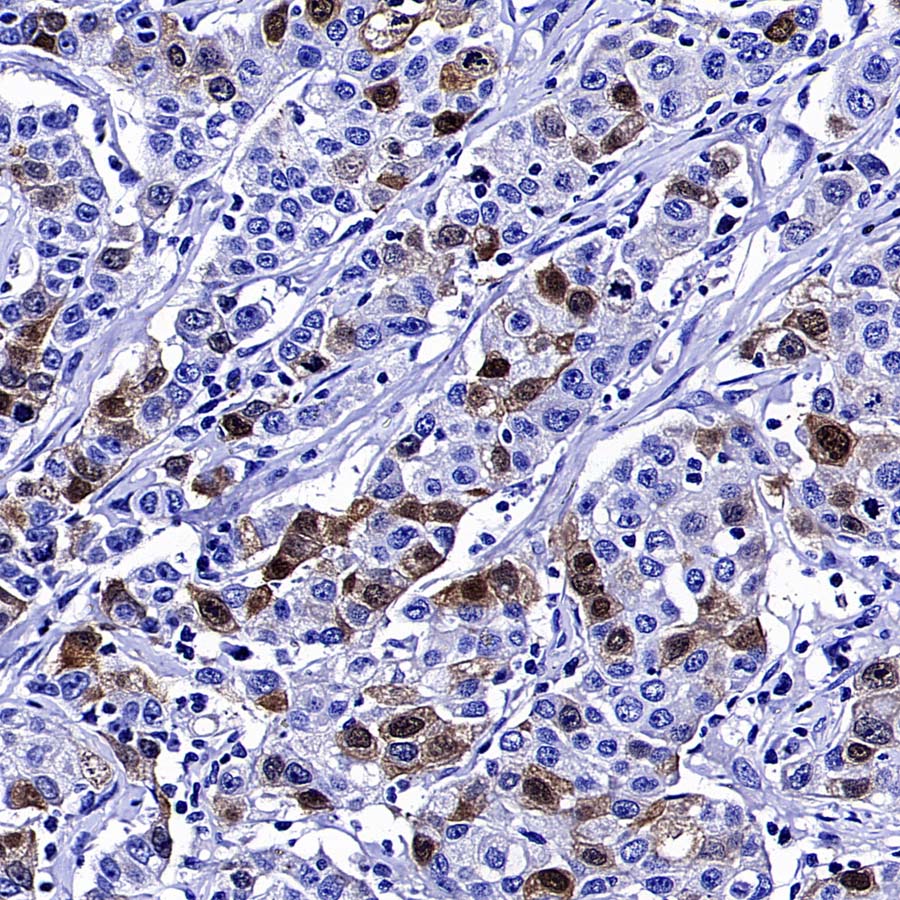 Thymidine Kinase 1 Recombinant Rabbit mAb (S-4127-43)