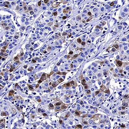 Thymidine Kinase 1 Recombinant Rabbit mAb (S-4127-43)