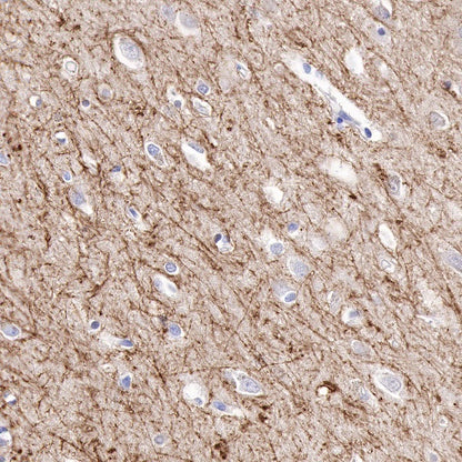 Myelin Basic Protein Recombinant Rabbit mAb (S-582-79)