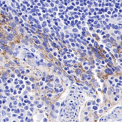 Claudin 3 Recombinant Rabbit mAb (S-819-131)