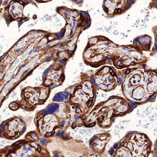 Non-muscle Myosin IIB/MYH10 Recombinant Rabbit mAb (S-299-3)