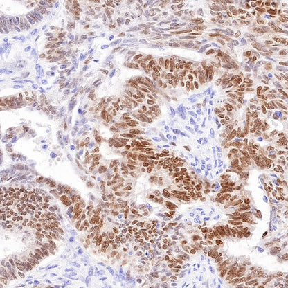 SOX17 Recombinant Rabbit mAb (SDT-1803-48)