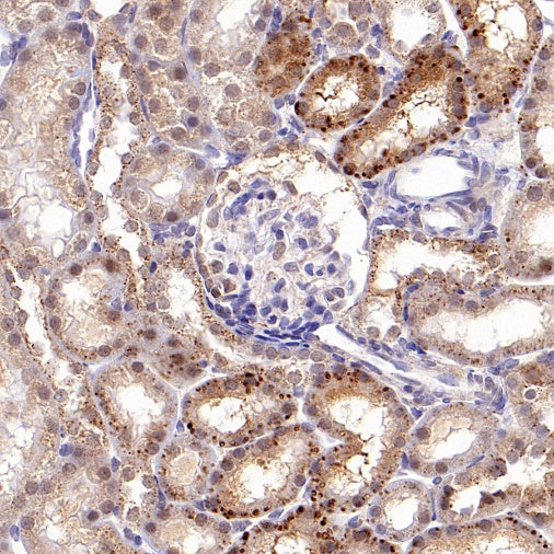 beta Galactosidase/GLB1 Recombinant Rabbit mAb (S-2295-7)