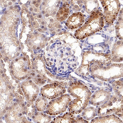 beta Galactosidase/GLB1 Recombinant Rabbit mAb (S-2295-7)