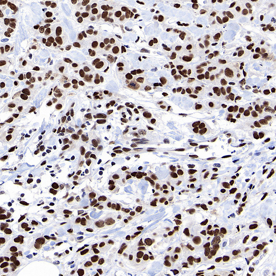 53BP1 Recombinant Rabbit mAb (S-3170-149)