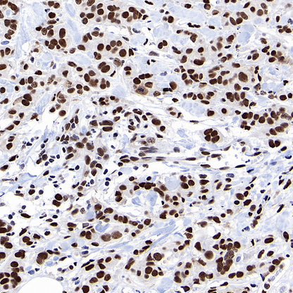 53BP1 Recombinant Rabbit mAb (S-3170-149)