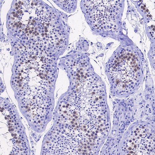DHFR Recombinant Rabbit mAb (S-2542-9)