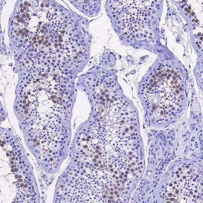 DHFR Recombinant Rabbit mAb (S-2542-9)
