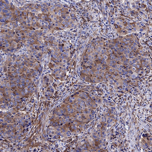 NF-κB p65 Recombinant Rabbit mAb (S-475-56)
