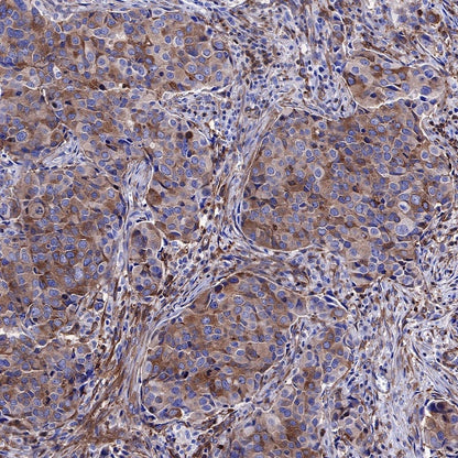 NF-κB p65 Recombinant Rabbit mAb (S-475-56)
