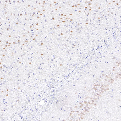 LMO4 Recombinant Rat mAb (S-5963)