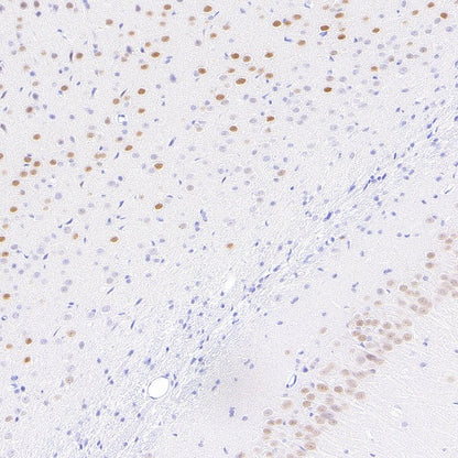LMO4 Recombinant Rat mAb (S-5963)