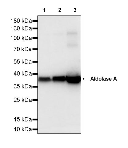 Aldolase A Recombinant Rabbit mAb (S-4007-23)
