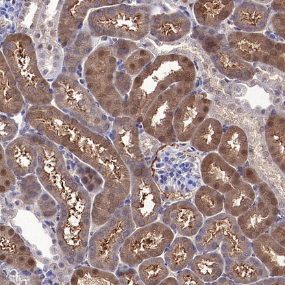 ATP Citrate Lyase Recombinant Rabbit mAb (S-5036)
