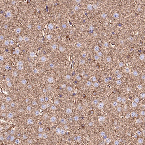 KIF5B+KIF5C Recombinant Rabbit mAb (S-2452-15)
