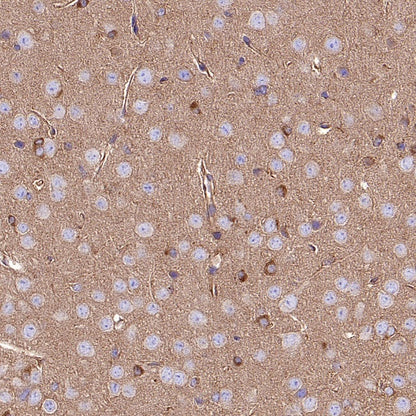 KIF5B+KIF5C Recombinant Rabbit mAb (S-2452-15)