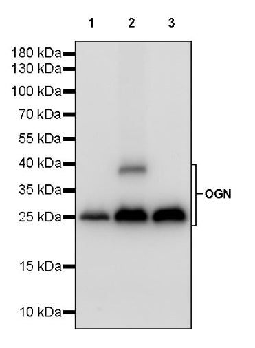 OGN Recombinant Rabbit mAb (S-245-327)