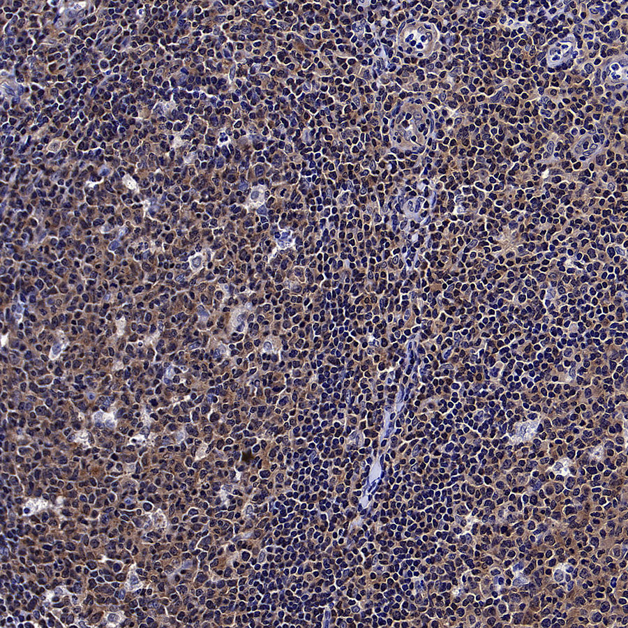 IRF3 Recombinant Rabbit mAb (S-3650-63)