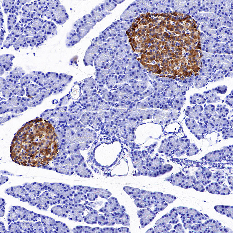 SV2A Recombinant Rabbit mAb (S-4049-16)