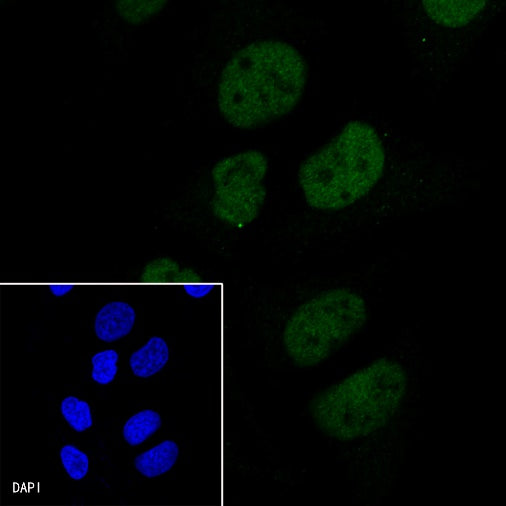 MLH1 Recombinant Rabbit mAb (SDT-112-50-2)