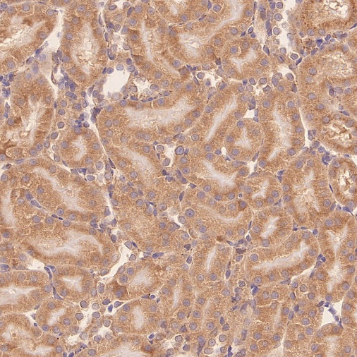 TUBA1B Rabbit Polyclonal Antibody