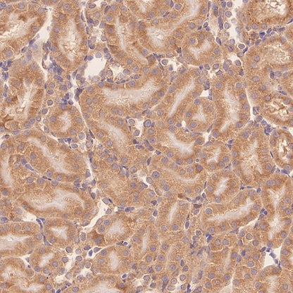 TUBA1B Rabbit Polyclonal Antibody