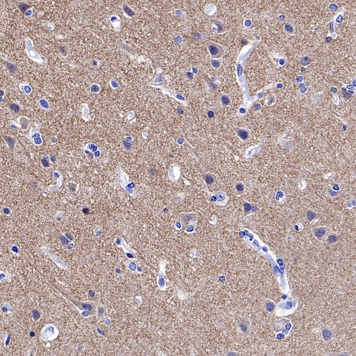 GRM5 Recombinant Rabbit mAb (SDT-2419-37)