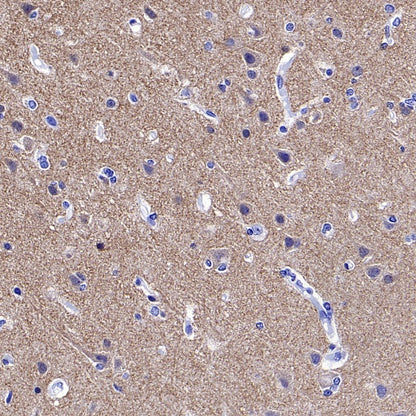 GRM5 Recombinant Rabbit mAb (SDT-2419-37)