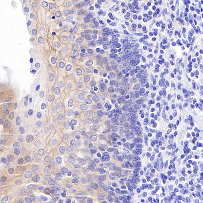 ErbB3 Recombinant Rabbit mAb (SDT-991-14)