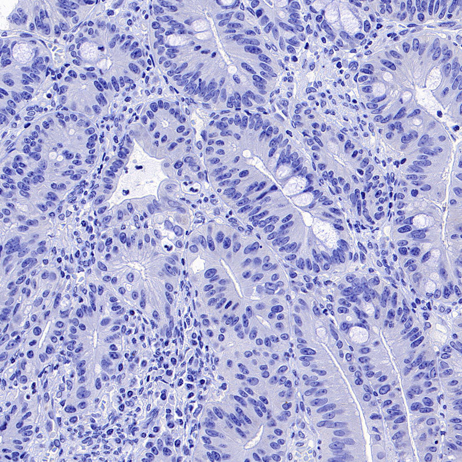 Phospho-Acetyl-CoA Carboxylase (Ser79) Recombinant Rabbit mAb (S-4302)