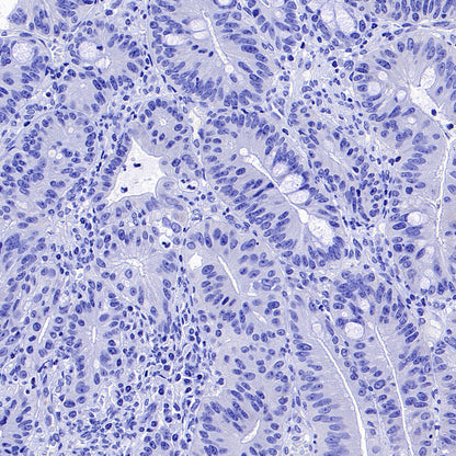 Phospho-Acetyl-CoA Carboxylase (Ser79) Recombinant Rabbit mAb (S-4302)