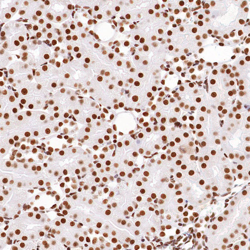 nmt55/p54nrb Recombinant Rabbit mAb (S-1745-48)
