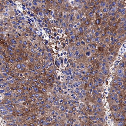 FASN Recombinant Rabbit mAb (S-682-32)